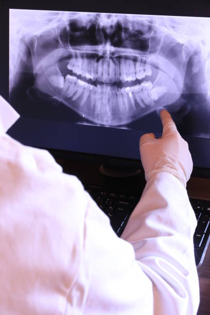 Best Emergency Root Canal Therapy in Lagrange, IN